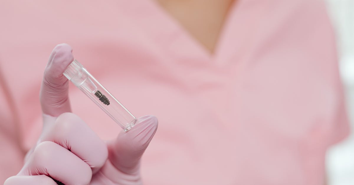 Cost Breakdown: All-on-4 Implants versus Traditional Implant Options