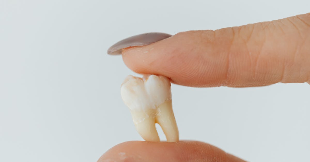 Evaluating the Financial Impact of Endosteal vs Subperiosteal Implants
