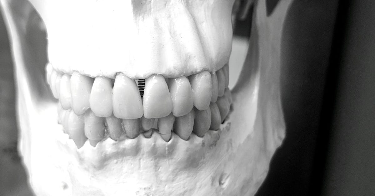 Factors Influencing the Average Cost of Dental Implants in Brisbane