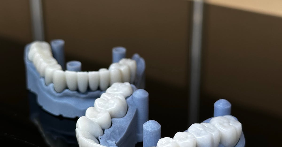 Financing Options to Manage the Average Dental Implant Cost in Brisbane