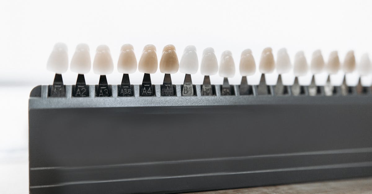 Hidden Costs Associated with Dental Implants in Brisbane