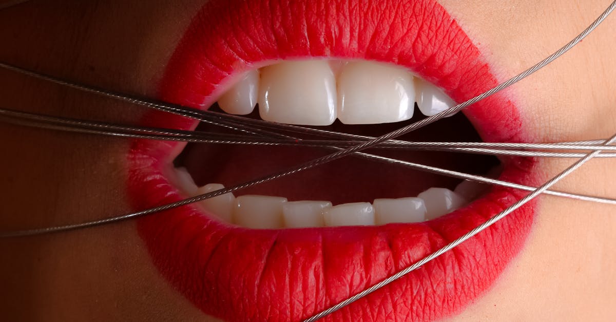 How to Maximise Your Dental Insurance for Implant Procedures