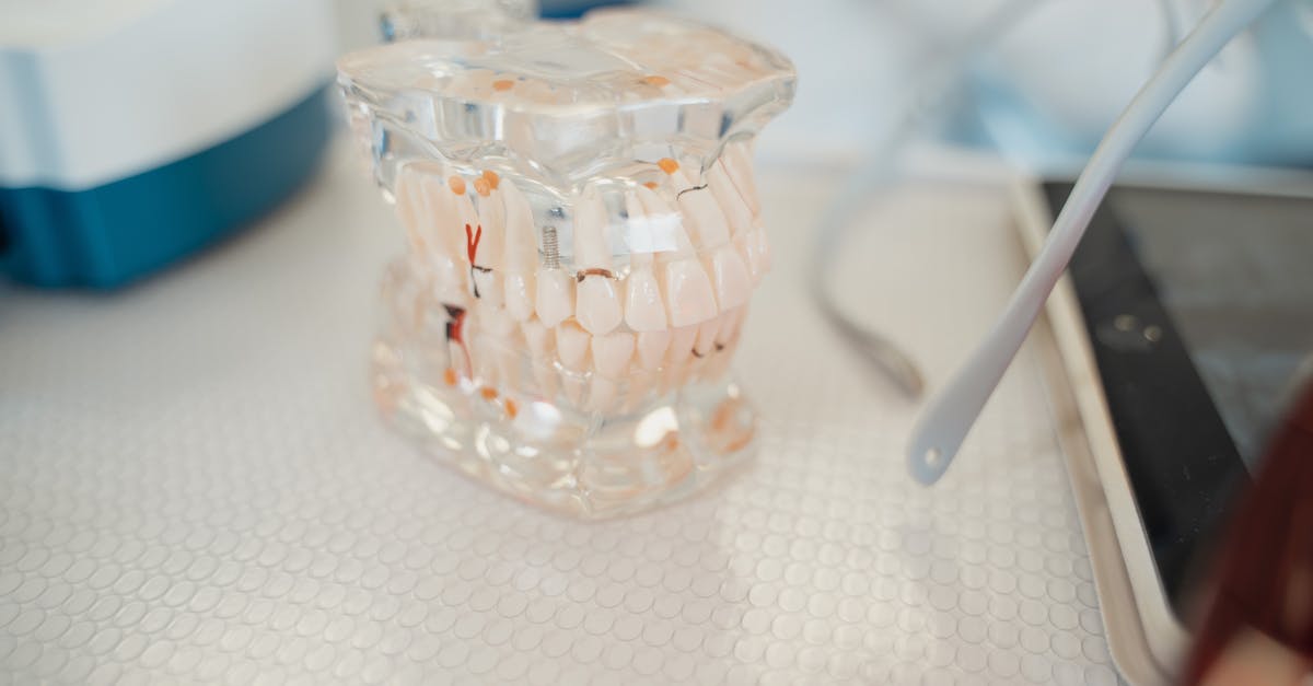 Identifying Signs of Infection in Dental Implants