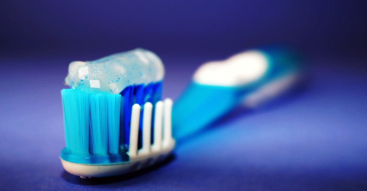 Importance of Regular Dental Check-ups for Implant Longevity