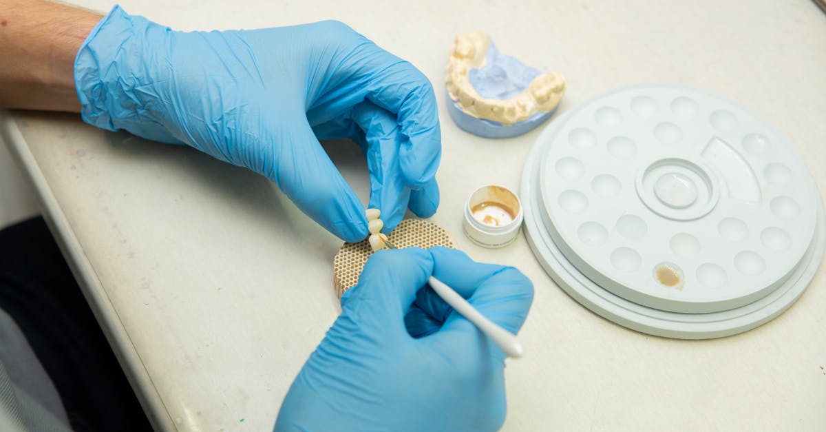 Maintenance Tips for Long-lasting All-on-4 Implants