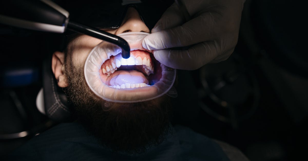 Navigating Sensitivity in Dental Implants: What to Expect