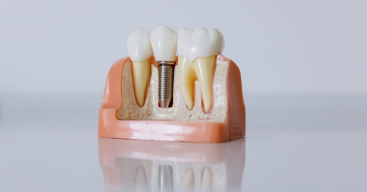 Navigating the Claims Process for Dental Implant Insurance