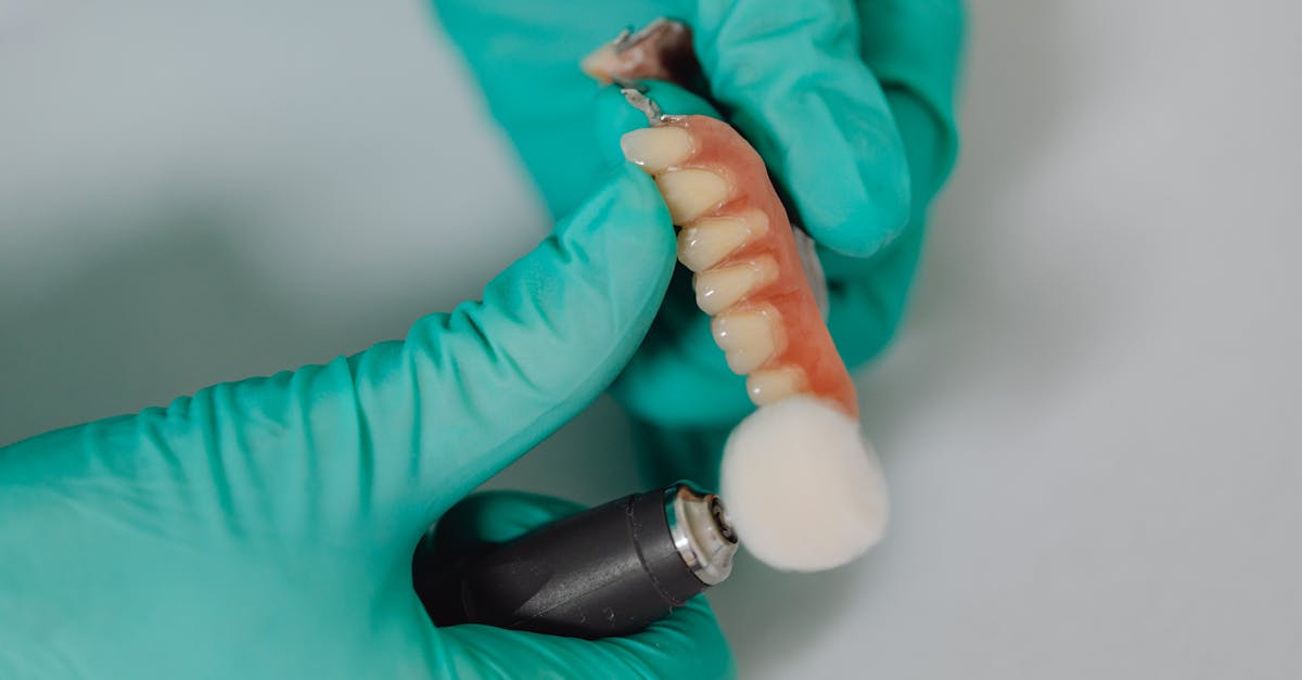 Qualifying for Dental Implant Subsidies: A Step-by-Step Guide