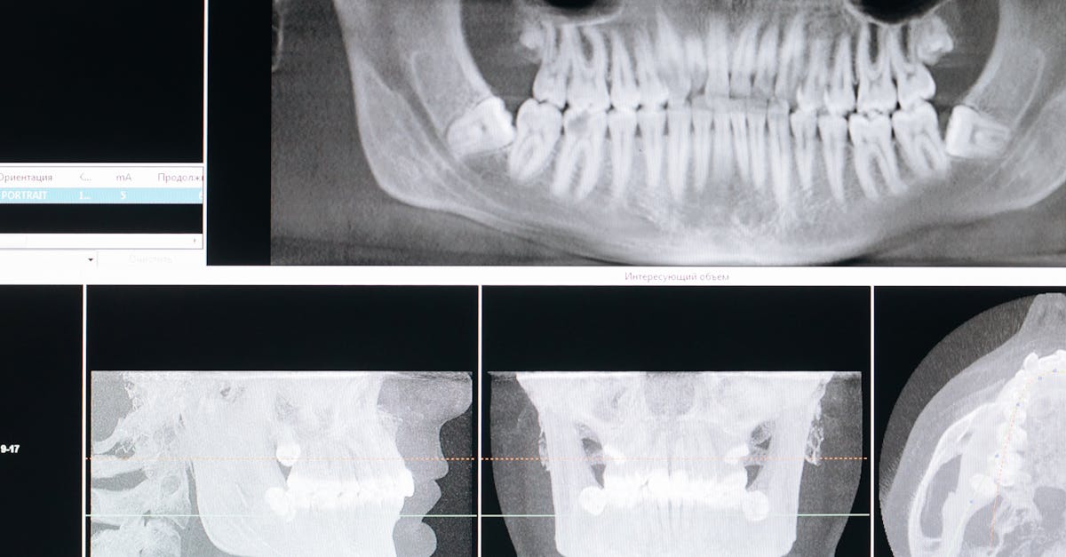 Resources for Finding Government Grants for Dental Care in Queensland