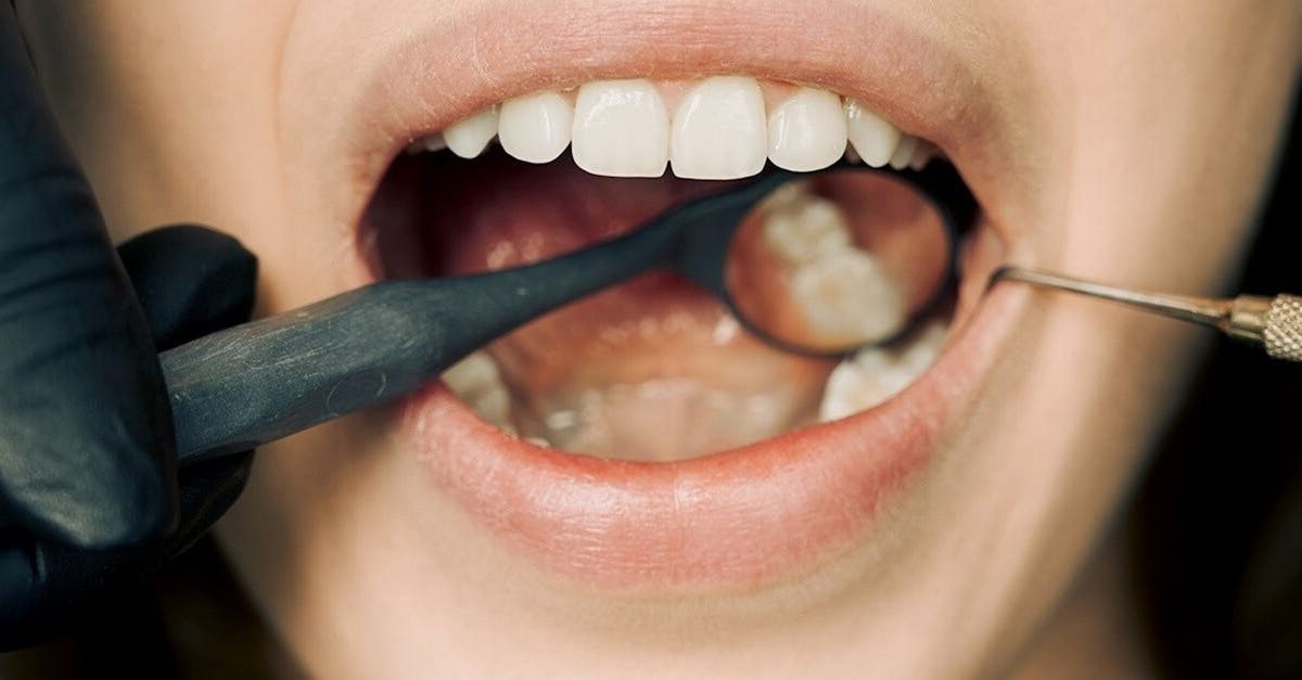 Role of Vitamins in Enhancing Implant Recovery