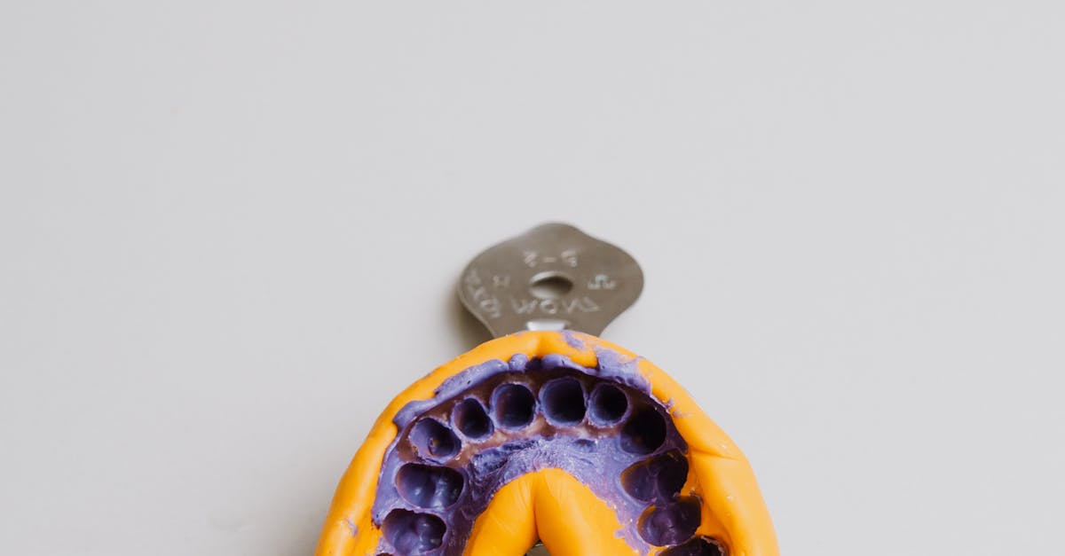 Steps to Maintain the Integrity of Your Dental Implants