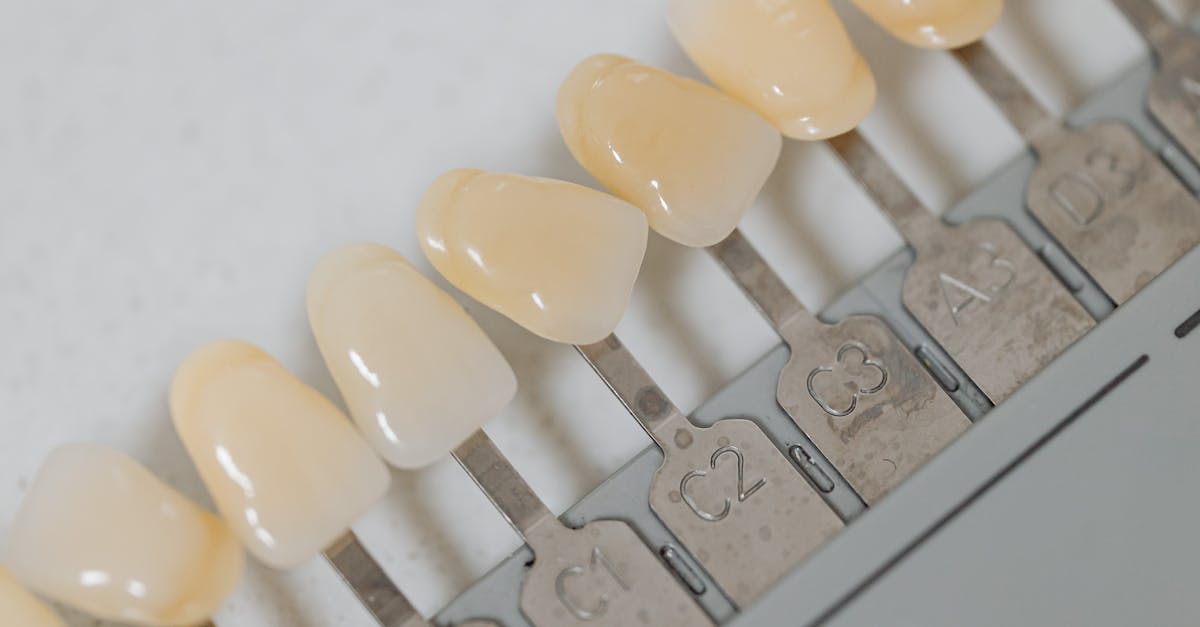 The Financial Implications of Choosing Zygomatic Implants Over Other Types