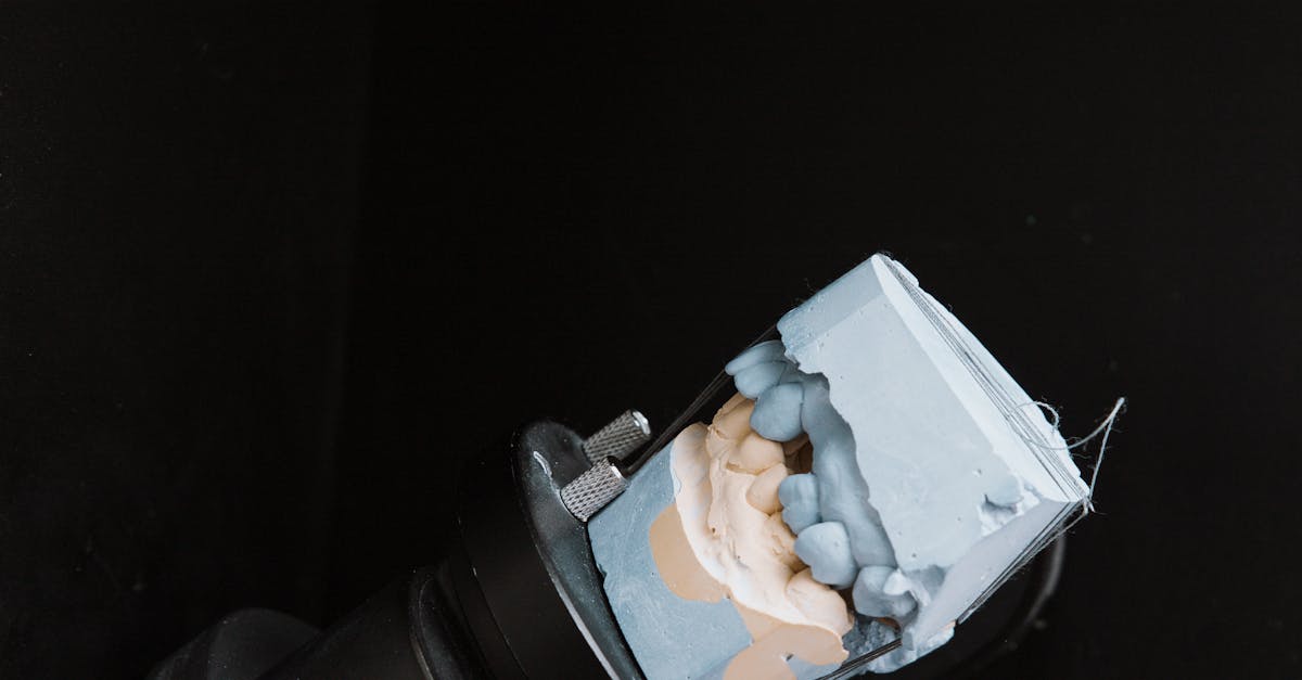 The Importance of Routine Care for Long-term Implant Success