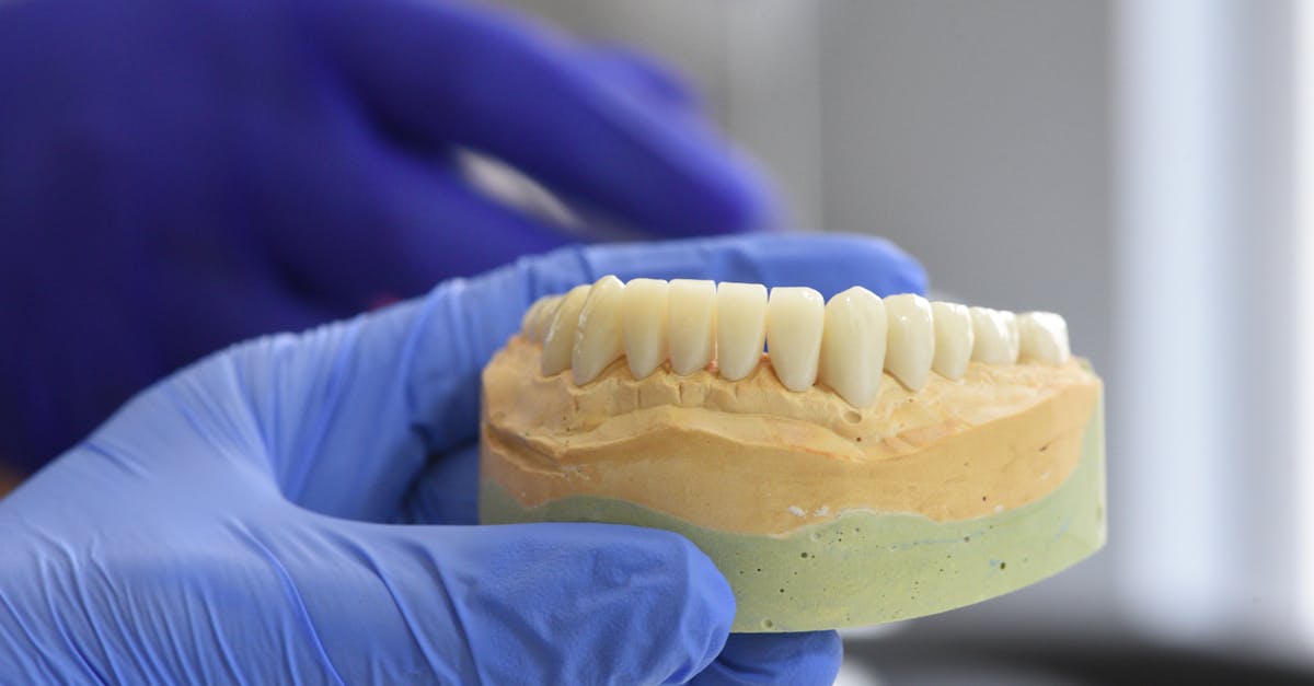 Tips for Coping with Swelling After Implant Surgery