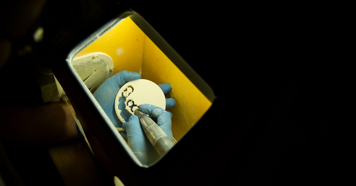 Understanding Possible Complications After Implant Placement