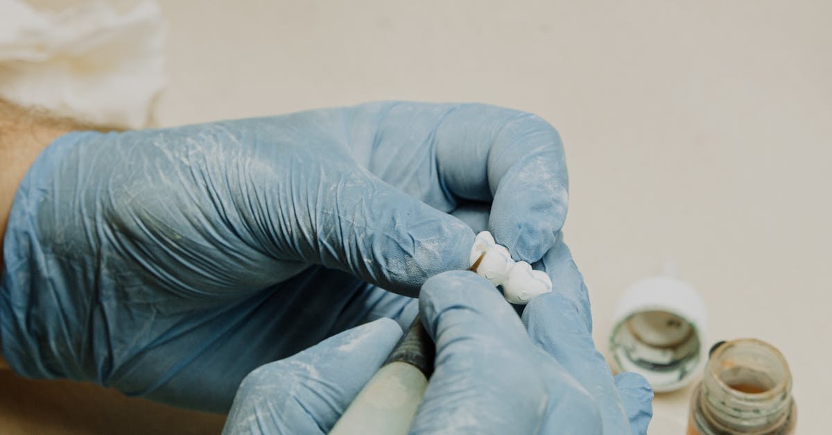 Understanding the Role of Professional Maintenance in Implant Longevity